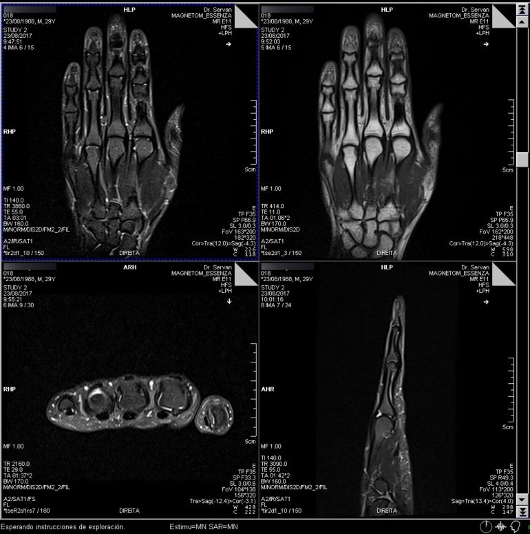 Resonancia Magnética Mano Centro Médico Dr Serván