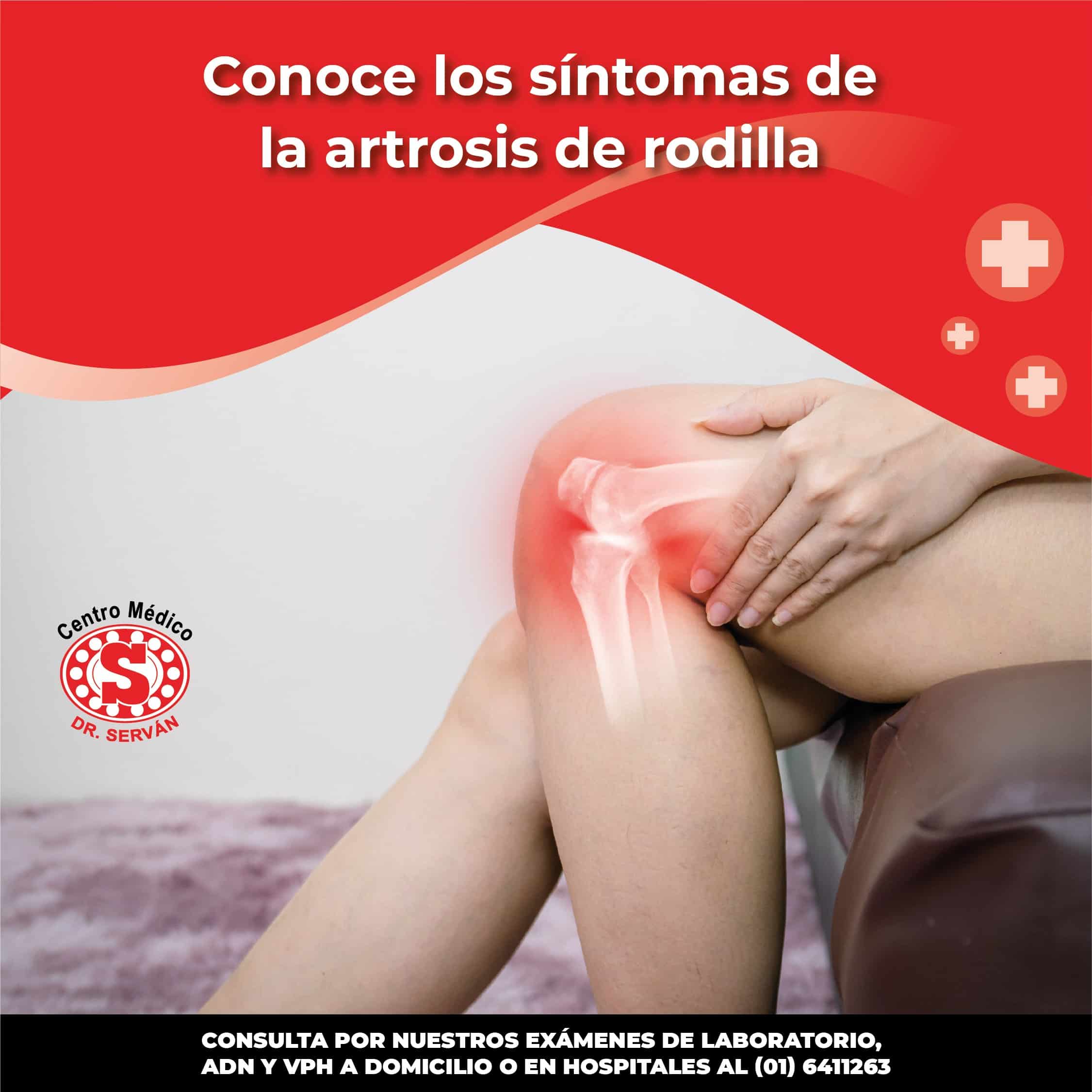 Artrosis de rodilla