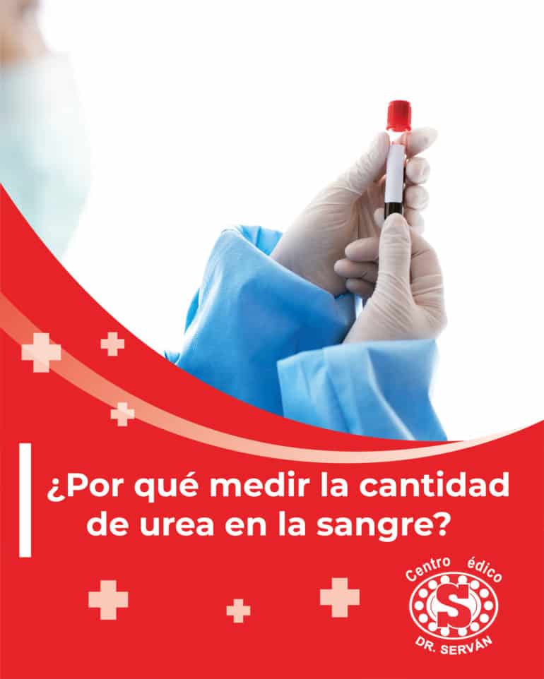 ¿por Qué Medir La Cantidad De Urea En La Sangre Centro Médico Dr Servánemk 5143