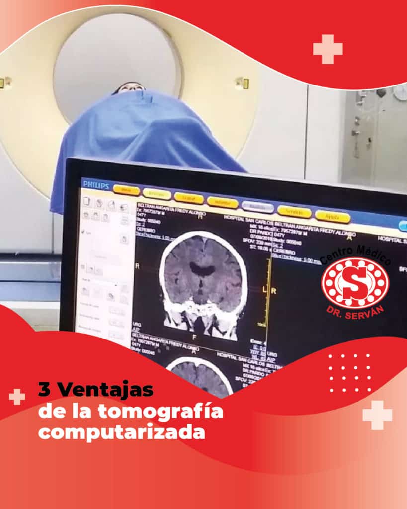 3 Ventajas De La Tomografía Computarizada Centro Médico Dr Serván 4366