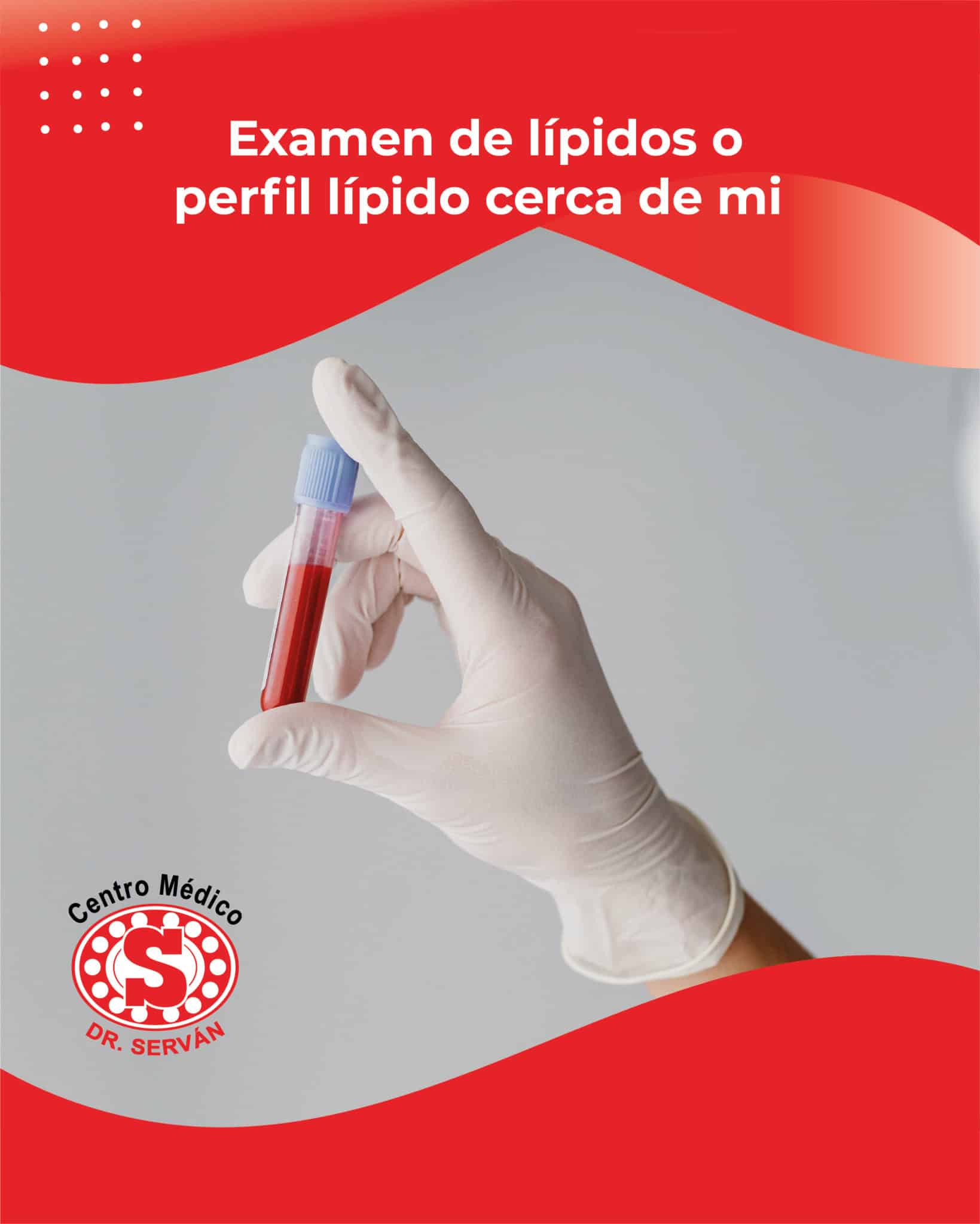 Examen De Lípidos O Perfil Lípido Cerca De Mi Centro Médico Dr Serván 6748