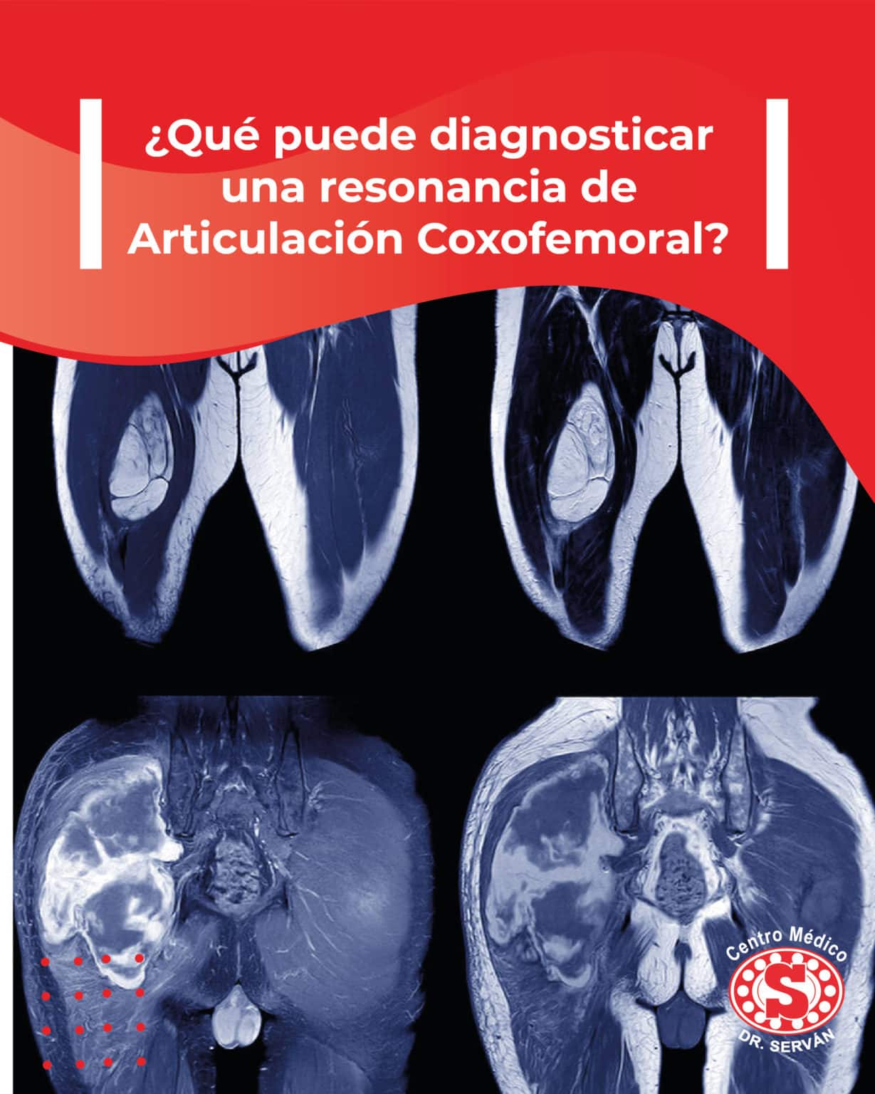 ¿qué Puede Diagnosticar Una Resonancia De Articulación Coxofemoral