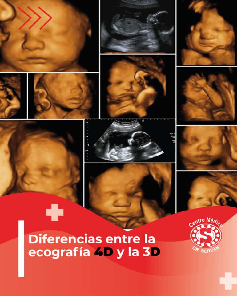 Diferencias Entre La Ecografía 4d Y La 3d Centro Médico Dr Serván 6174