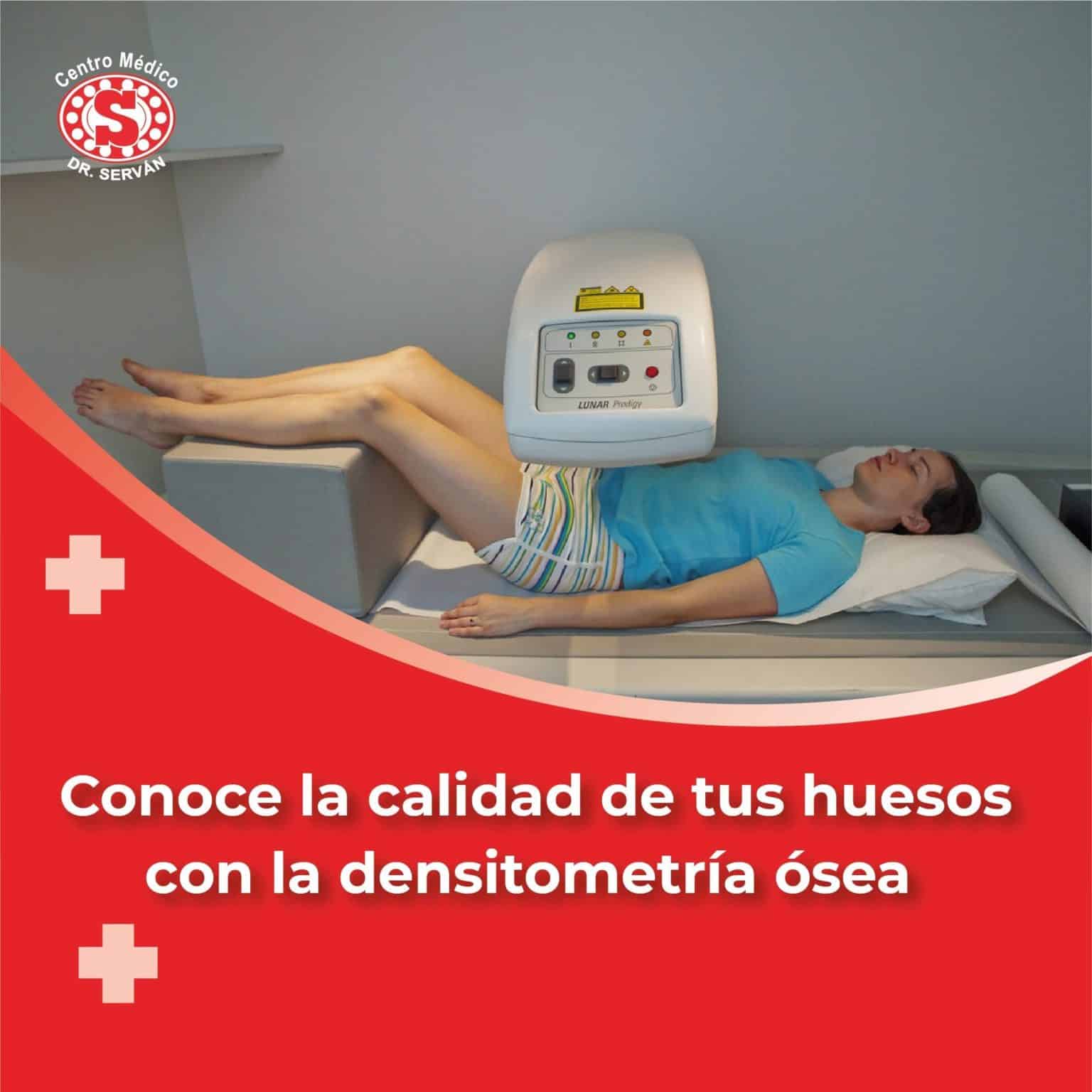 Conoce La Calidad De Tus Huesos Con La Densitometría ósea Centro Médico Dr Serván 