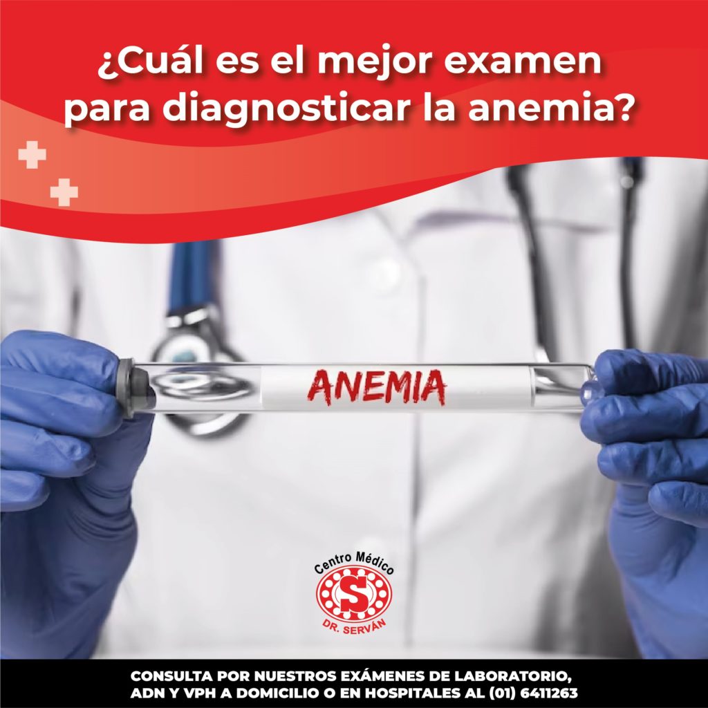 ¿Cuál Es El Mejor Examen Para Diagnosticar La Anemia? - Centro Médico ...