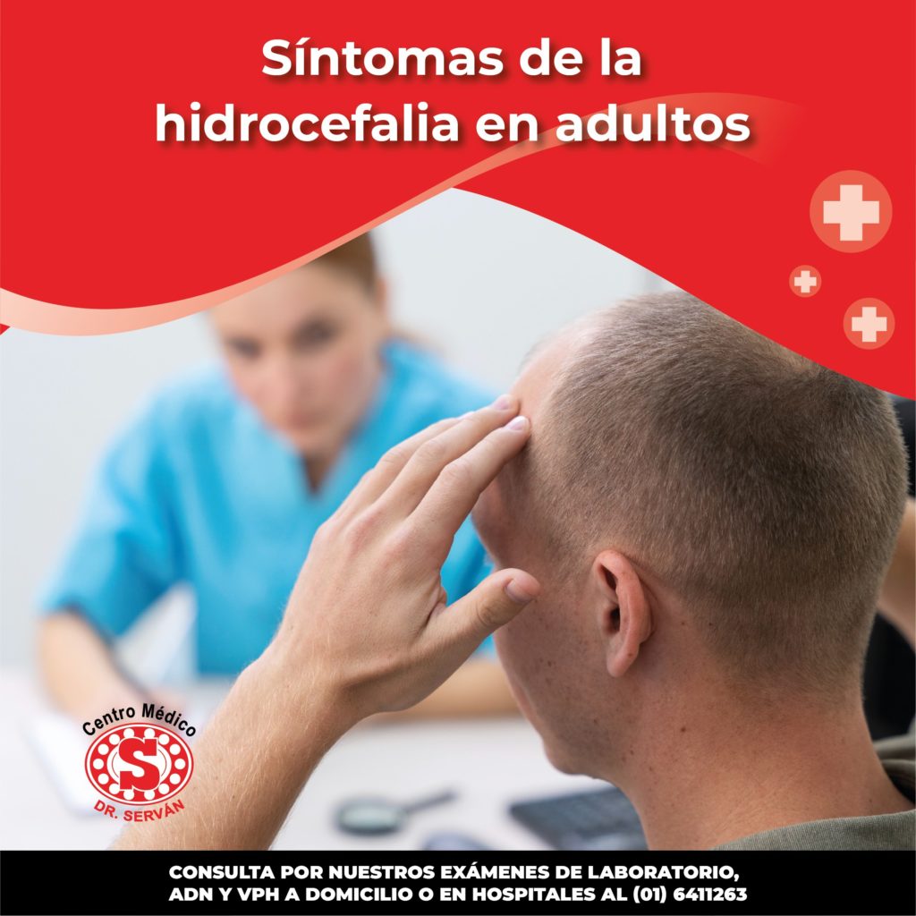 Síntomas De La Hidrocefalia En Adultos Centro Médico Dr Serván 2534