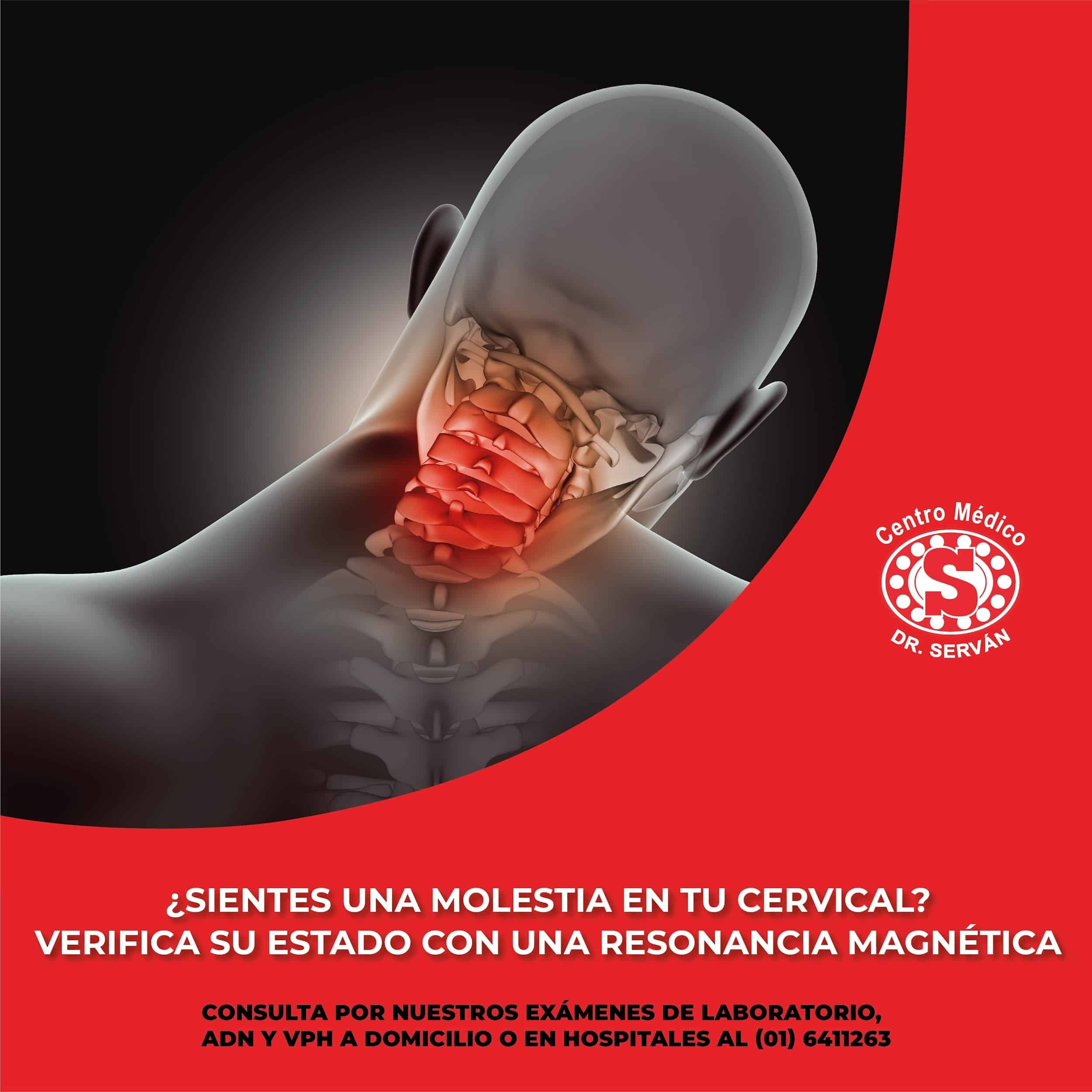 Cervical – Centro Médico Dr. Serván